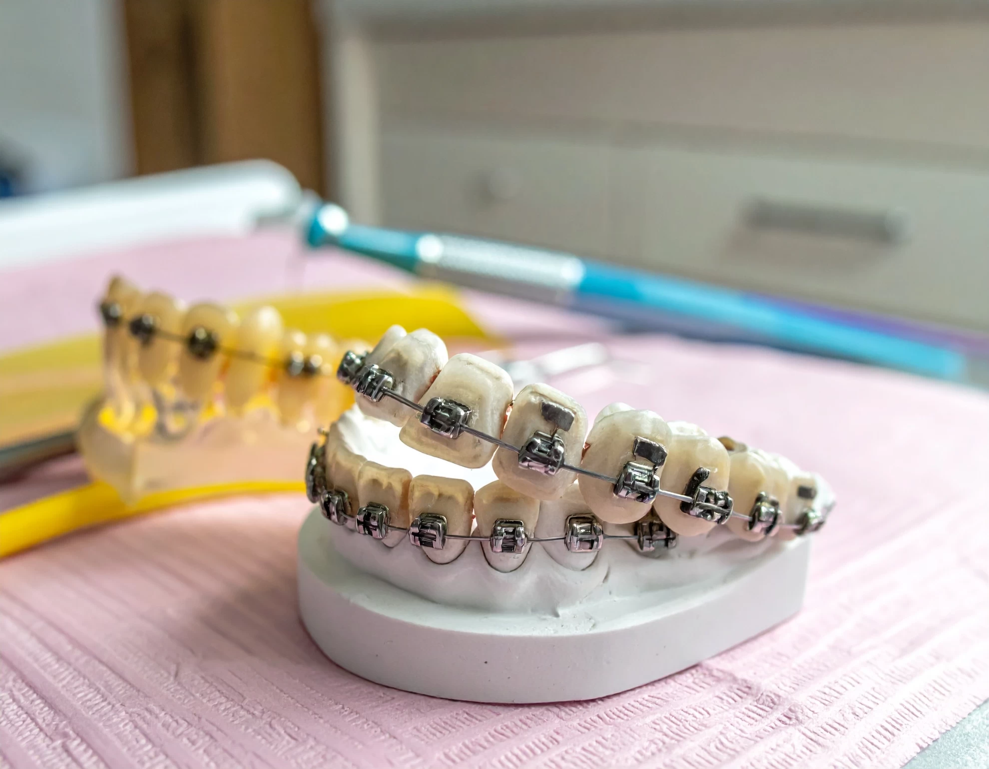 咬合不正 3 種治療方式對比！牙套、齒列調整哪種適合你？